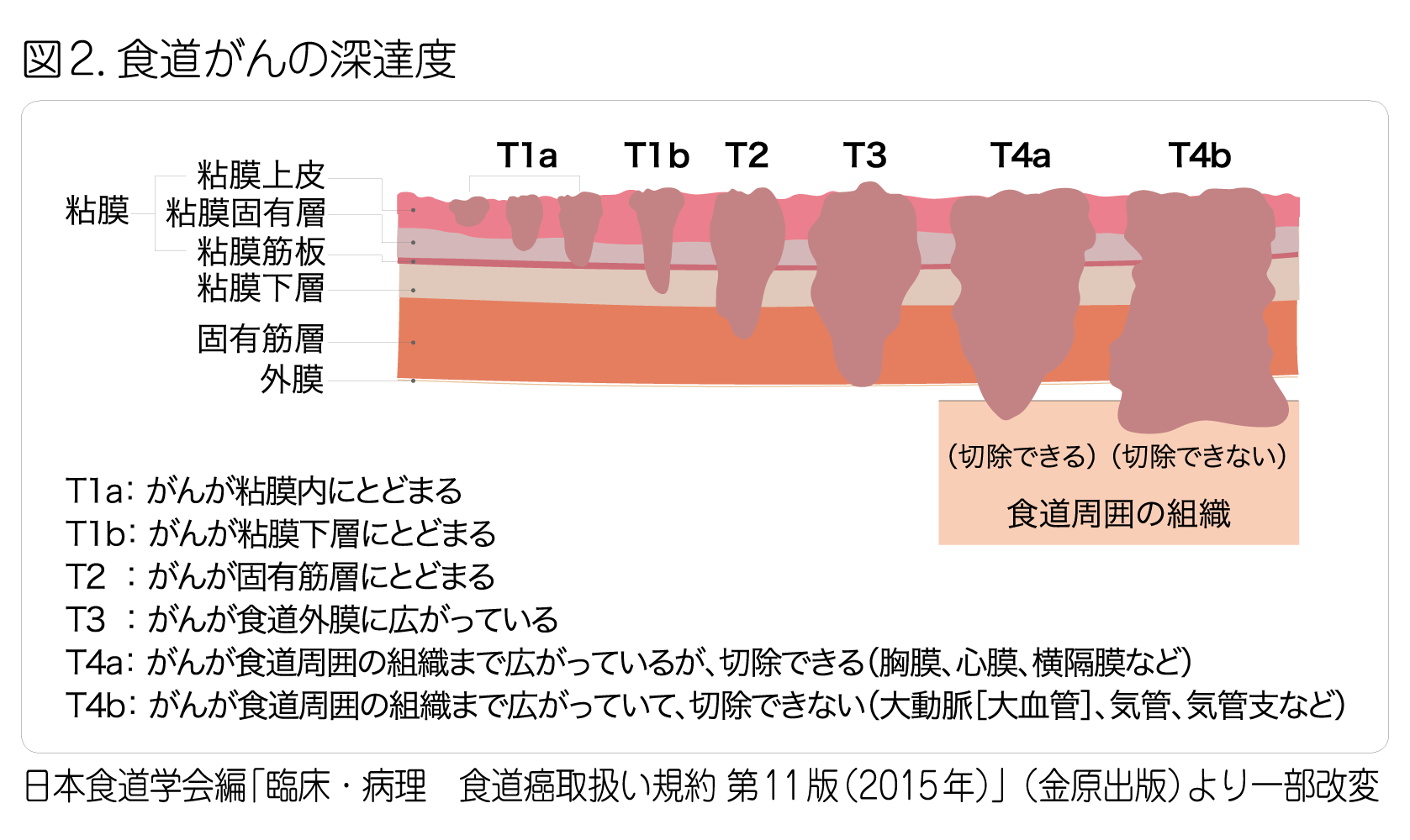 ファムトラスツズマブ デルクステカン (エンヘルツ)